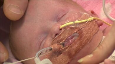 Nace en Reino Unido un bebé con el corazón fuera del pecho