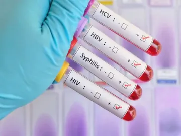 Infecciones de transmisión sexual Infecciones de transmisión sexual