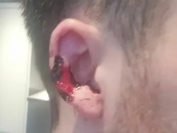 La oreja de la víctima La oreja de la víctima
