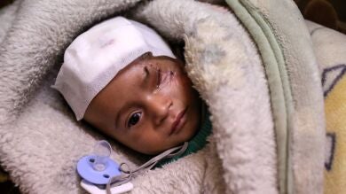 Lanzan una campaña en solidaridad con Karim, un niño herido en un bombardeo en Siria