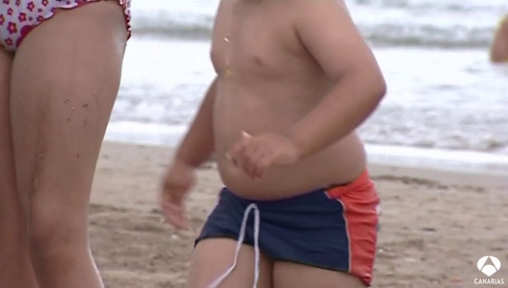 Casi la mitad de los niños canarios sufren obesidad o sobrepeso