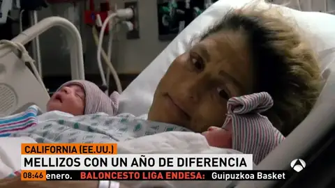 Nacen dos mellizos en años diferentes en California Nacen dos mellizos en años diferentes en California