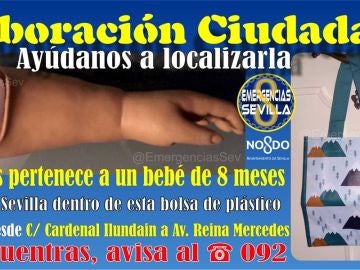 Prótesis extraviada en Sevilla Prótesis extraviada en Sevilla