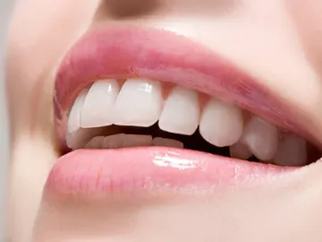 Remedios caseros con alimentos para blanquear tus dientes Remedios caseros con alimentos para blanquear tus dientes