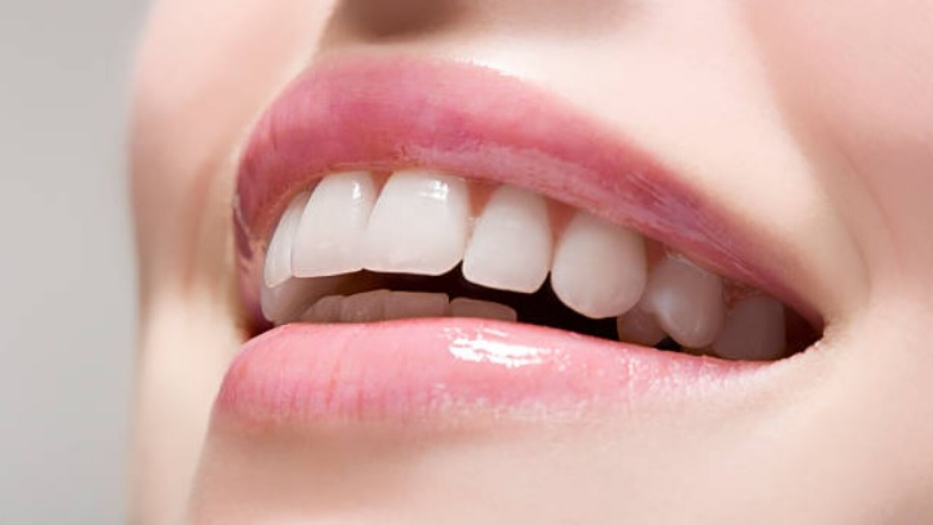 Remedios caseros con alimentos para blanquear tus dientes