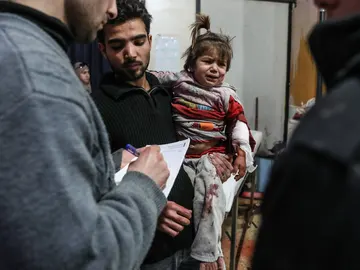 Una niña herida recibe atención médica después de bombardeos Una niña herida recibe atención médica después de bombardeos