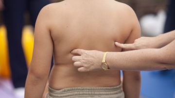 Investigación de la influencia genética en la obesidad infantil (foto cedida por 'Precipita')