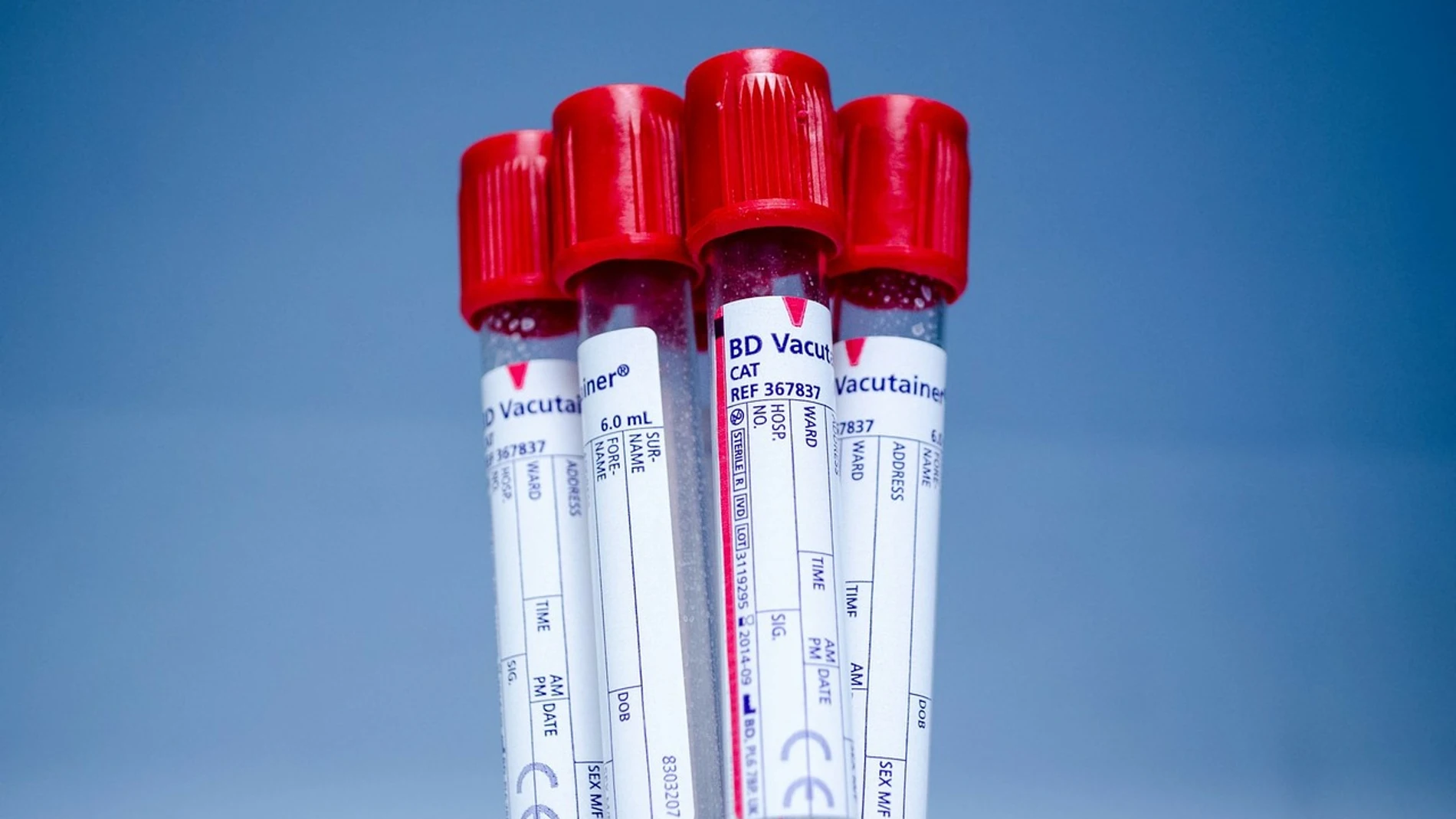 Foto de archivo tubos de laboratorio Foto de archivo tubos de laboratorio