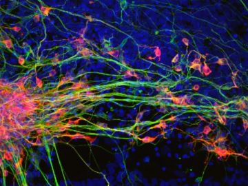 La proteina RAC1 nueva diana contra la degeneracion neuronal en parkinson