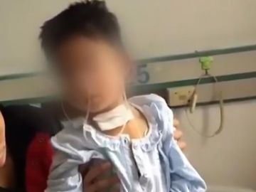 Una aguja atraviesa la garganta de un niño en China