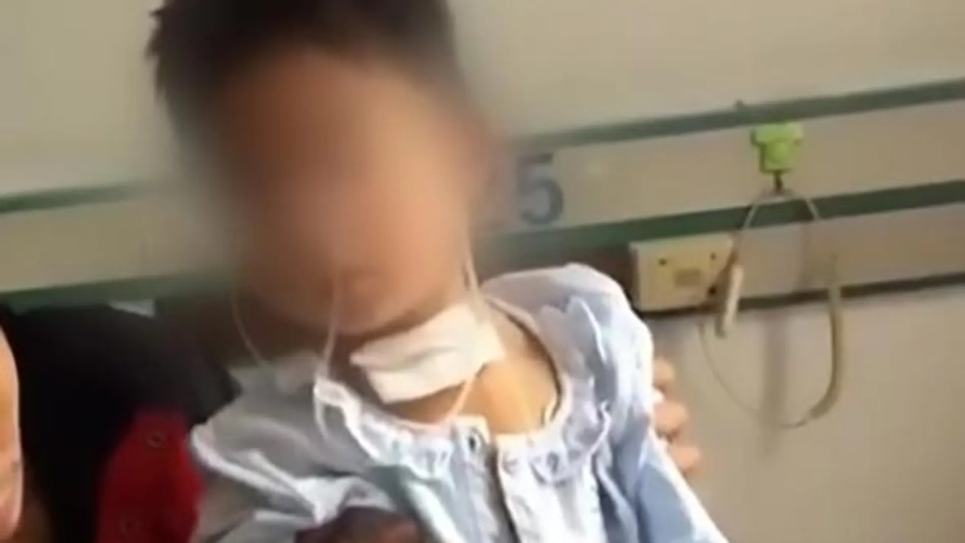 Una aguja atraviesa la garganta de un niño en China Una aguja atraviesa la garganta de un niño en China