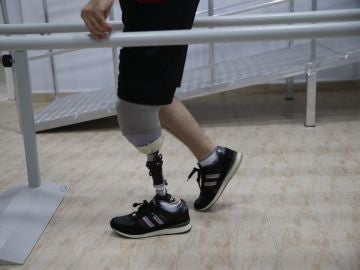 Un hombre camina gracias a una prótesis