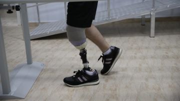 Un hombre camina gracias a una prótesis
