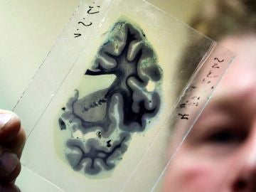Un científico analiza una radiografía del cerebro humano.