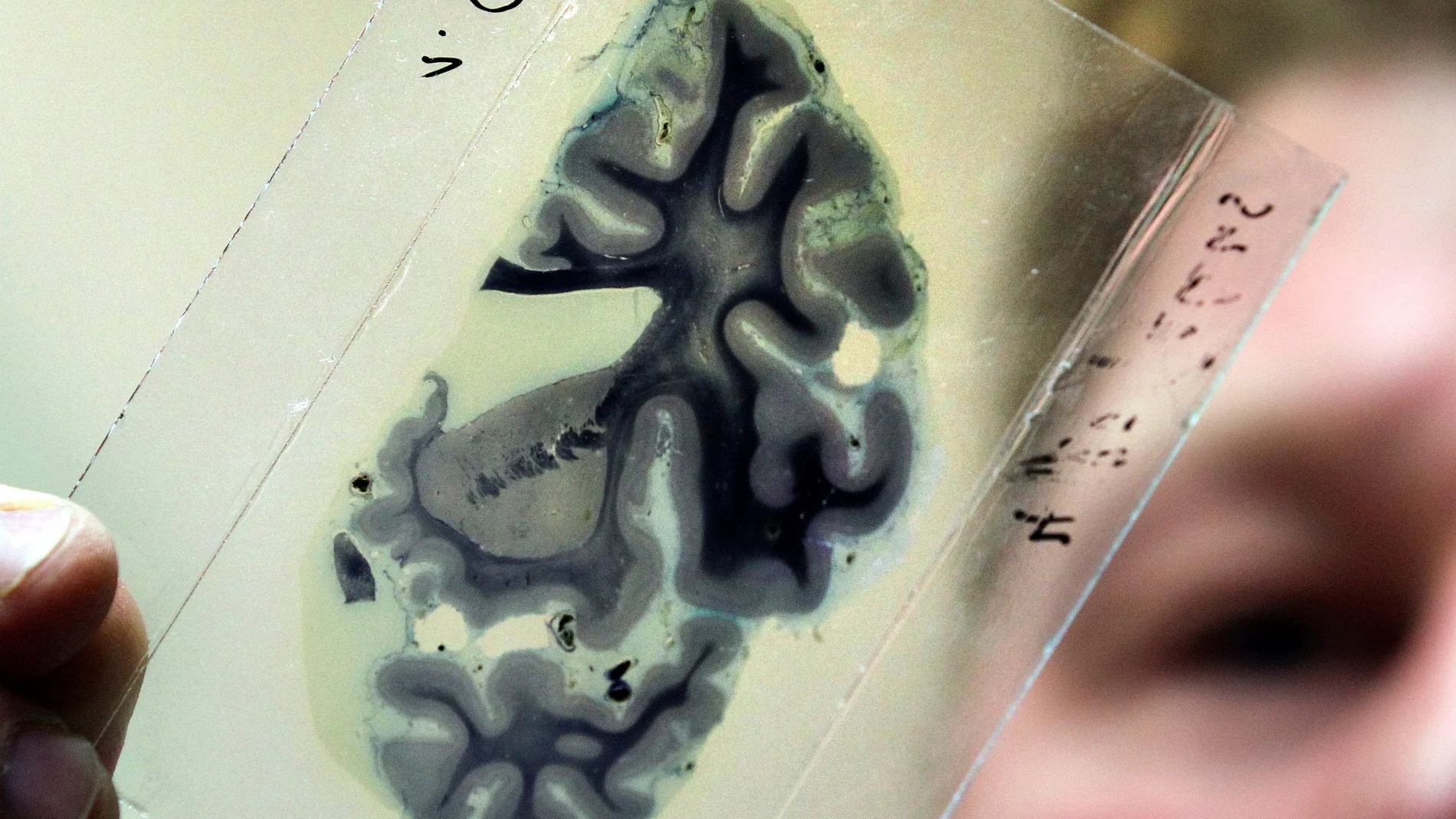 Un científico analiza una radiografía del cerebro humano. Un científico analiza una radiografía del cerebro humano.
