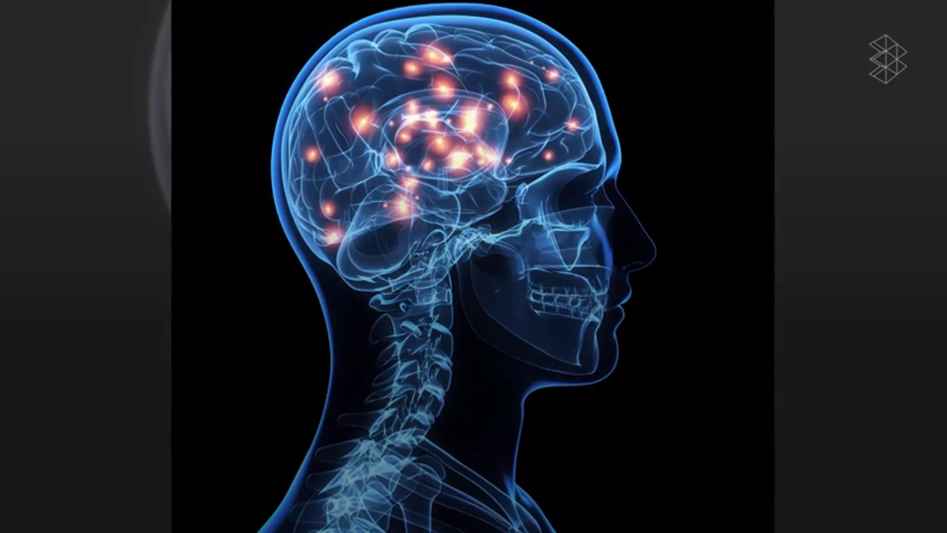 Un cerebro Un cerebro