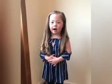 Chloe, la niña con síndrome de Down Chloe, la niña con síndrome de Down