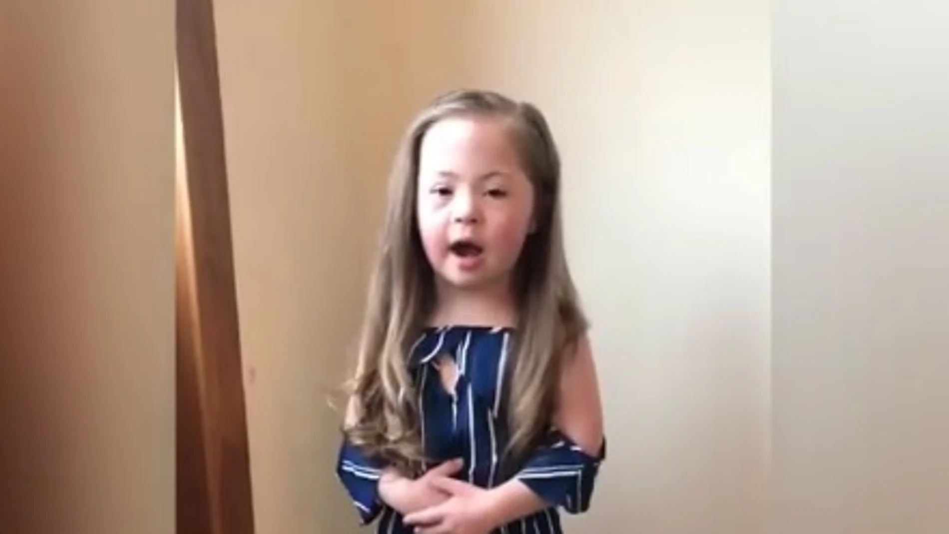 Chloe, la niña con síndrome de Down Chloe, la niña con síndrome de Down