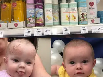 Una madre descubre una crema de bebés de 4 euros que cura el eczema infantil y la psoriasis adulta Una madre descubre una crema de bebés de 4 euros que cura el eczema infantil y la psoriasis adulta
