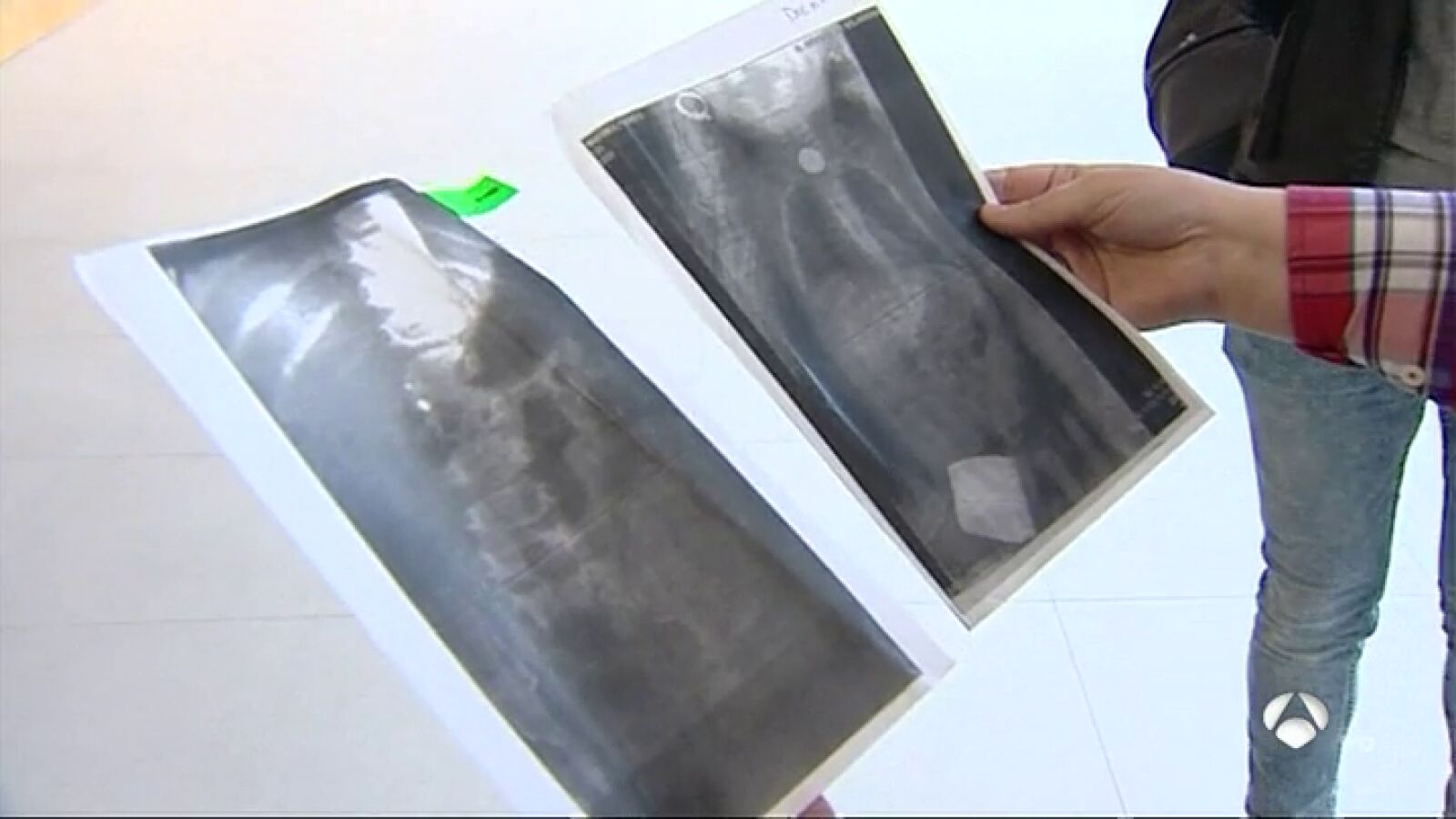 Tres médicos sancionados con 540 euros de multa por negligencia médica