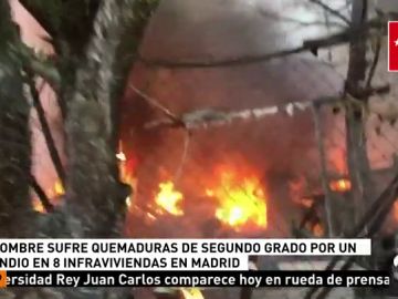 Un hombre ha resultado herido en un incendio en Pinto