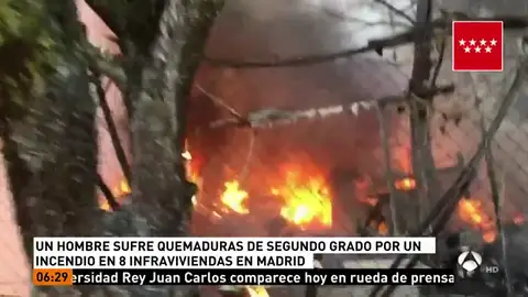 Un hombre ha resultado herido en un incendio en Pinto Un hombre ha resultado herido en un incendio en Pinto