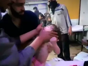 Niños atendidos tras el ataque químico en Duma Niños atendidos tras el ataque químico en Duma