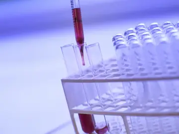 Análisis de sangre Análisis de sangre