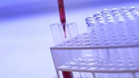 Análisis de sangre Análisis de sangre