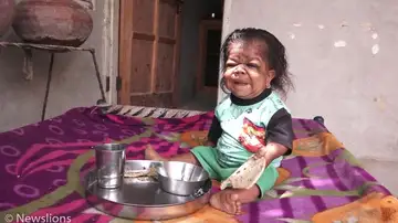 El joven atrapado en el cuerpo de un bebé El joven atrapado en el cuerpo de un bebé