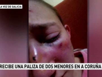 Recibe una paliza por no dar su número de teléfono