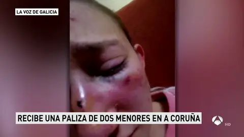 Recibe una paliza por no dar su número de teléfono Recibe una paliza por no dar su número de teléfono