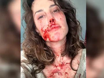 Natalia de Molina muestra la realidad de la secuencia más dura de 'La Catedral del Mar' Natalia de Molina muestra la realidad de la secuencia más dura de 'La Catedral del Mar'