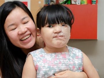 Reconstrucción de rostro a una niña de cinco años