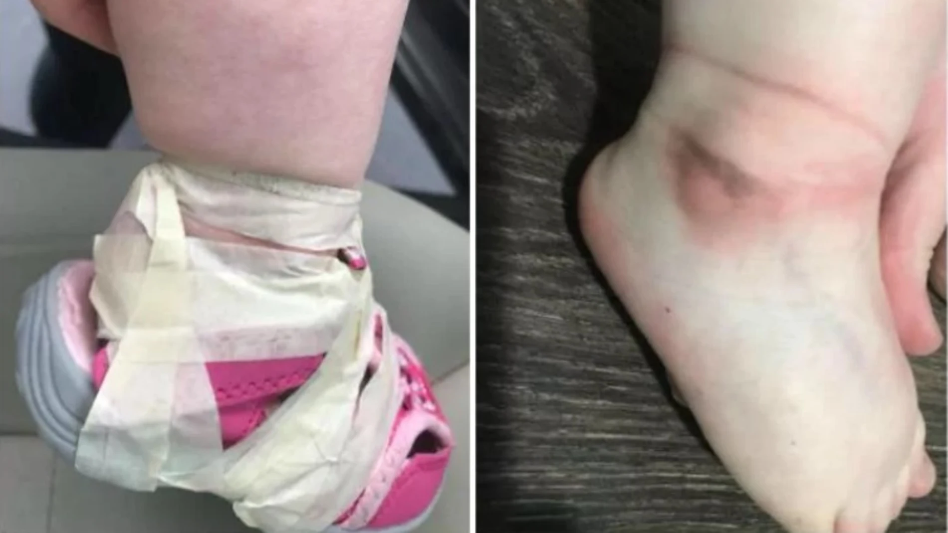 Los zapatos atados con cinta aislante Los zapatos atados con cinta aislante
