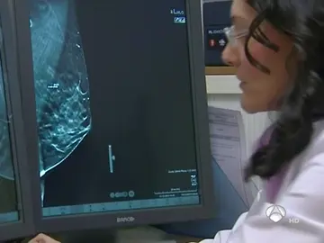 Mamografía es la técnica diagnóstica de cáncer de mama Mamografía es la técnica diagnóstica de cáncer de mama