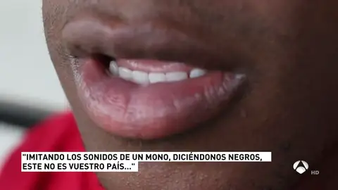 RacismoA3D RacismoA3D
