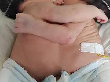 Las dos siamesas Las dos siamesas