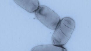 Salmonella enterica es uno de los principales pat&oacute;genos ent&eacute;ricos tanto en pa&iacute;ses desarrollados como en regiones en v&iacute;as de desarrollo.