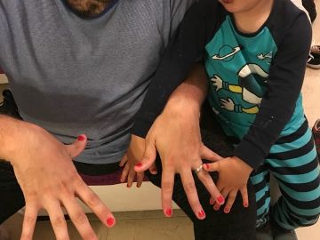 Un padre se pinta las uñas por su hijo