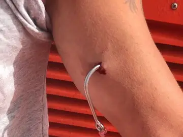 Salvamento Marítimo evacua a un marinero con un anzuelo clavado en el brazo Salvamento Marítimo evacua a un marinero con un anzuelo clavado en el brazo