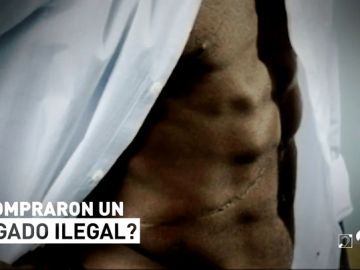 Cebo Deportes 4/07/18: '¿Compraron un hígado ilegal?'