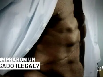 Cebo Deportes 4/07/18: '¿Compraron un hígado ilegal?' Cebo Deportes 4/07/18: '¿Compraron un hígado ilegal?'