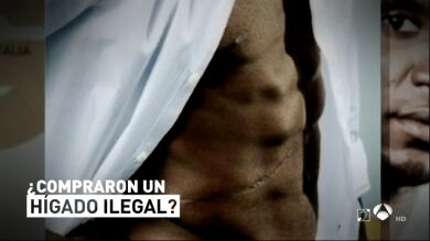 Cebo Deportes 4/07/18: '¿Compraron un hígado ilegal?'