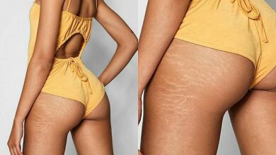 Las redes sociales celebran que una marca de ropa no elimine las estrías de sus modelos 
