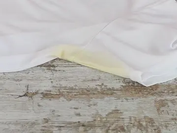 Manchas amarillas Manchas amarillas