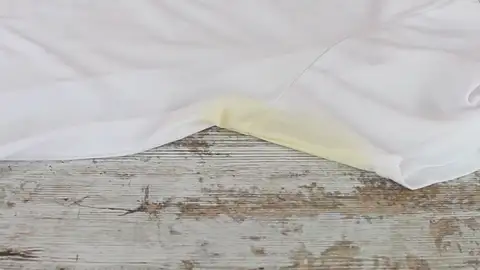 Manchas amarillas Manchas amarillas