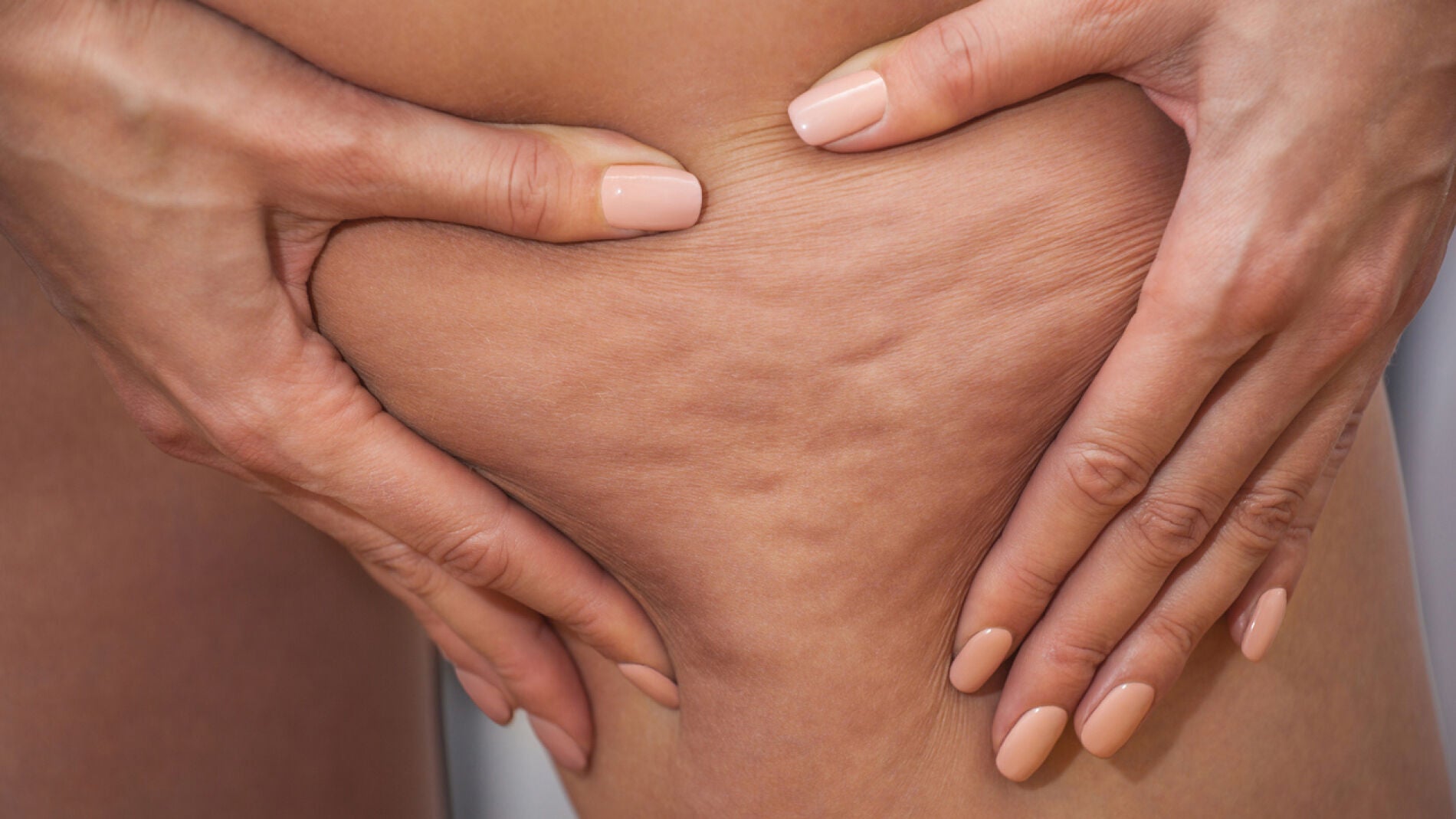 Cómo combatir la celulitis