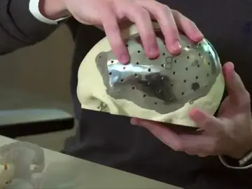 Una empresa brasileña crea partes del cuerpo artificiales con impresión 3D Una empresa brasileña crea partes del cuerpo artificiales con impresión 3D