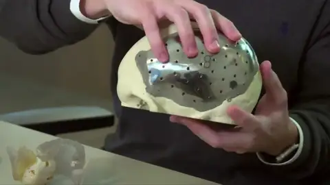 Una empresa brasileña crea partes del cuerpo artificiales con impresión 3D Una empresa brasileña crea partes del cuerpo artificiales con impresión 3D